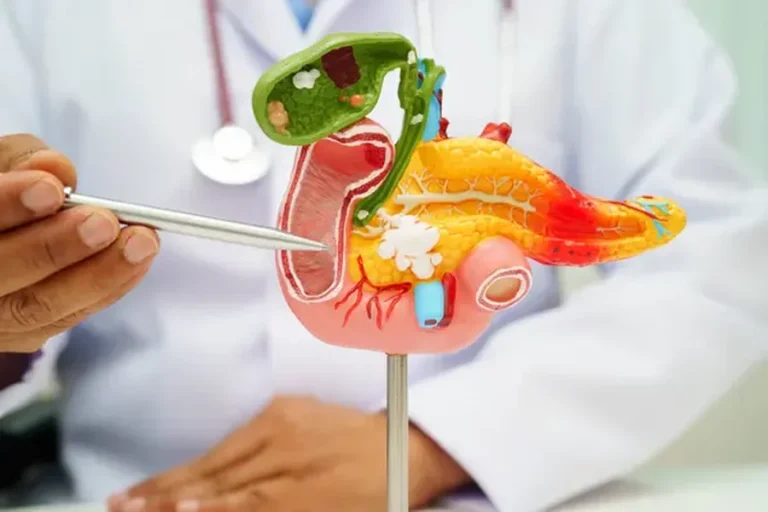 Pancreatic Cancer Care